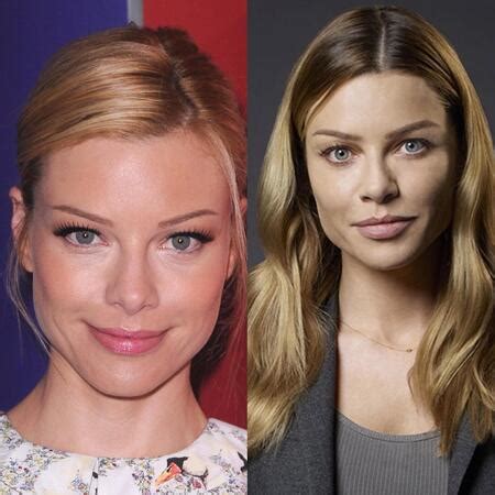 lauren german plastic surgery